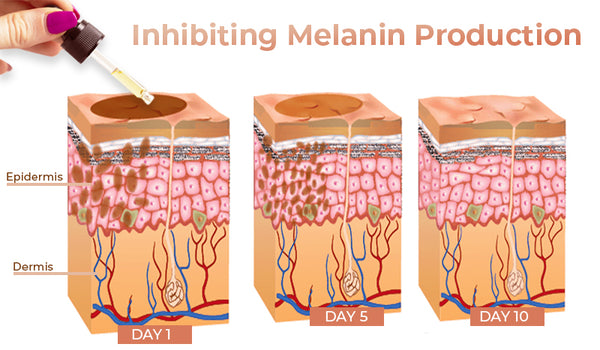 GFOUK™ Melanin korrigierendes Gesichtsserum