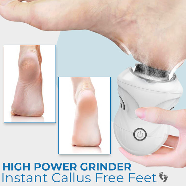 Callus-free feet, footcare