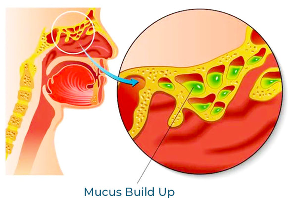 GFOUK™ Nasal Mucus Cleansing Spray