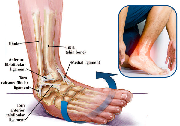 GFOUK™ German Ankle Tendonitis Therapy Oil