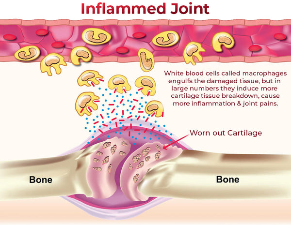 GFOUK™ JointMax Discomfort and Inflammation Relief Foam