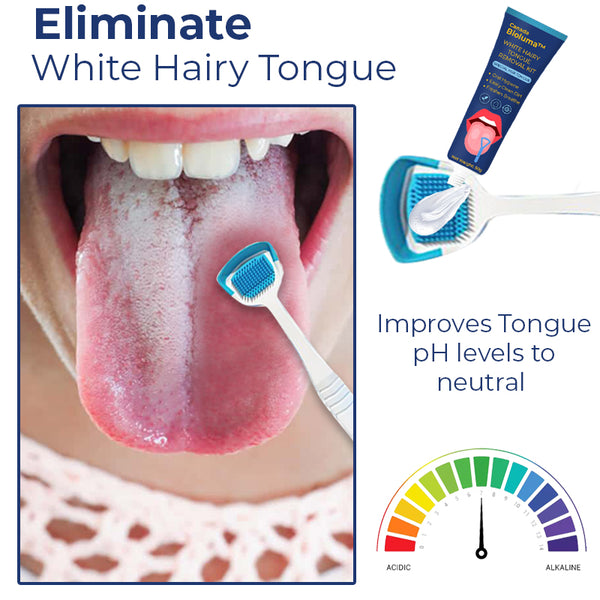 Canada Bioluma™ White Hairy Tongue Removal Kit