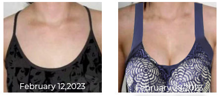 GFOUK™ SwellFree Shaper Bra