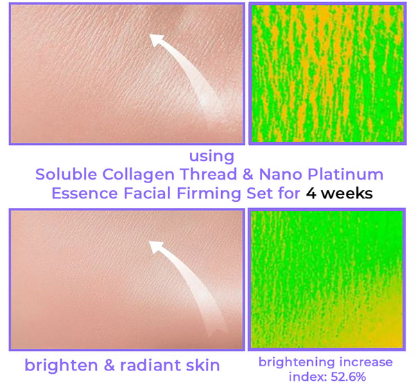 Soluble Collagen Thread & Nano Platinum Essence Gesichtsstraffungsset