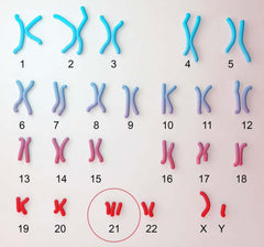 Chromosome 21
