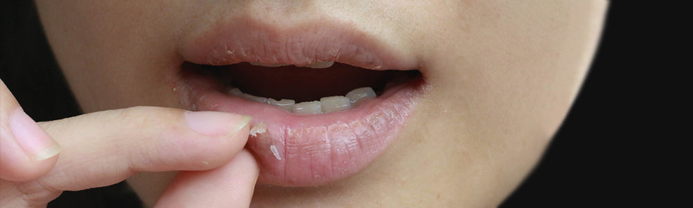 Susu juga bisa bermanfaat untuk melembabkan kulit bibir kamu yang kering lho.