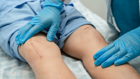 doctor examining patient with knee scars post surgery