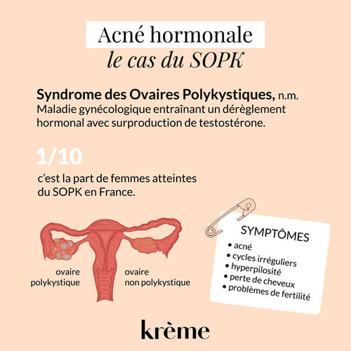 Acné hormonale : comment s'en débarrasser ? | Krème