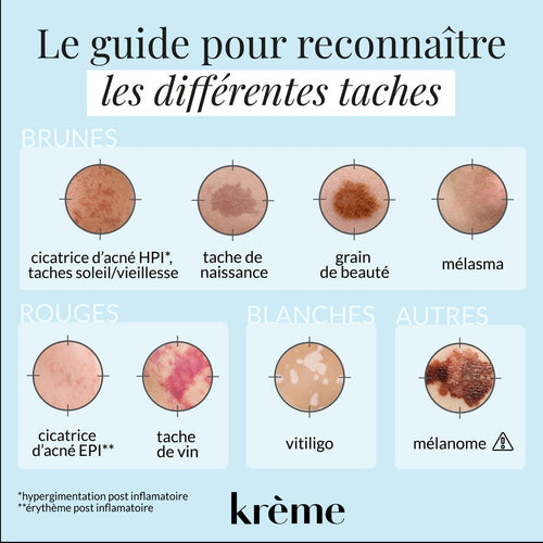 Taches brunes visage : comment s'en débarrasser ? | Krème