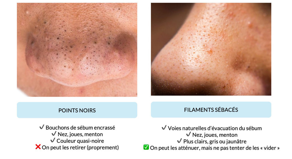 Masque points noirs : conseils et astuces