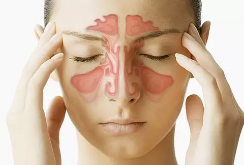 como melhorar a sinusite