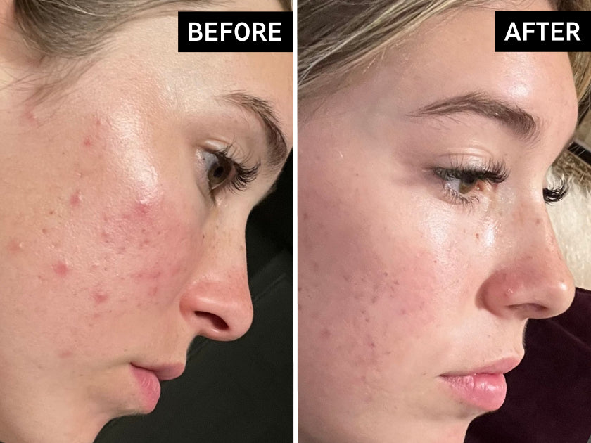 Before and after comparison