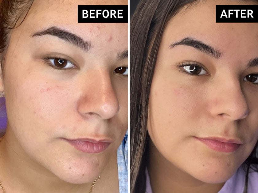 Before and after comparison