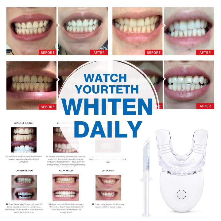 Smile™ Teeth Whitening Kit