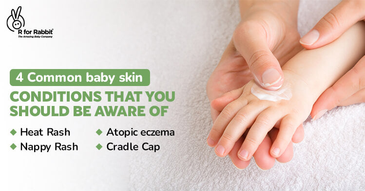 4 Common baby skin conditions that you should be aware of