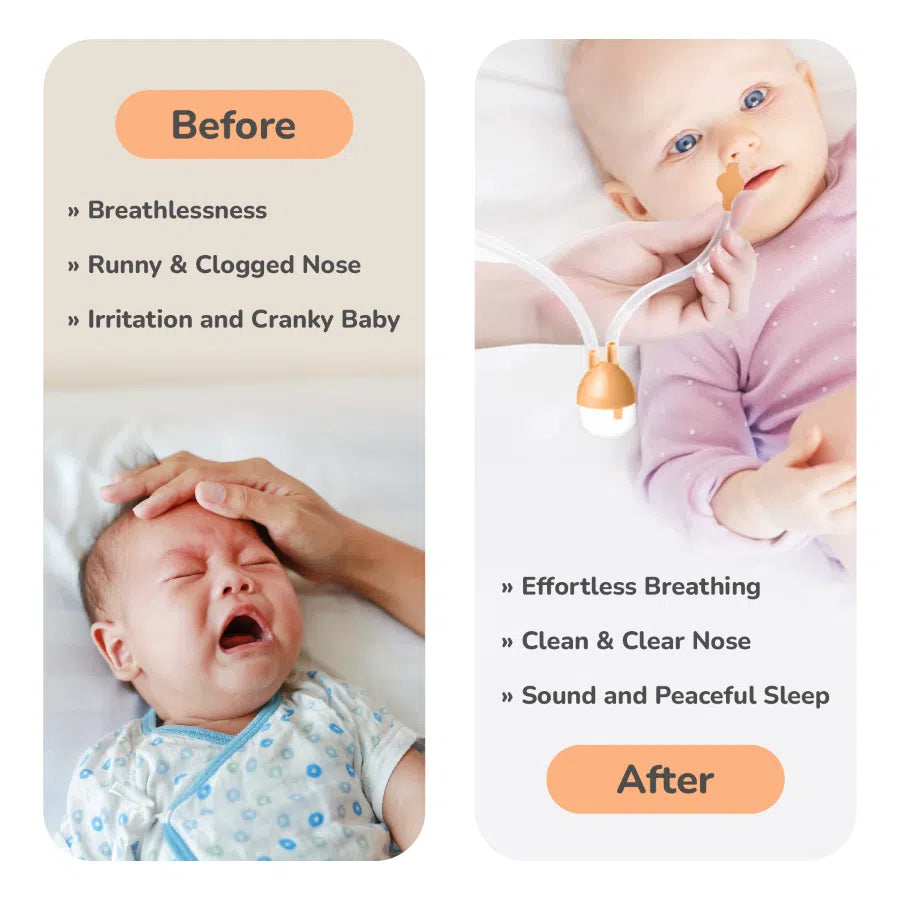 Snowy Nasal Cleaner For Baby Painless Relief from Mucus and Blocked Nose