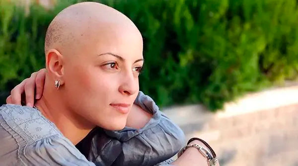 hair loss during chemo