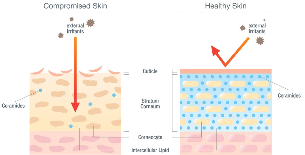 Compromised versus healthy skin