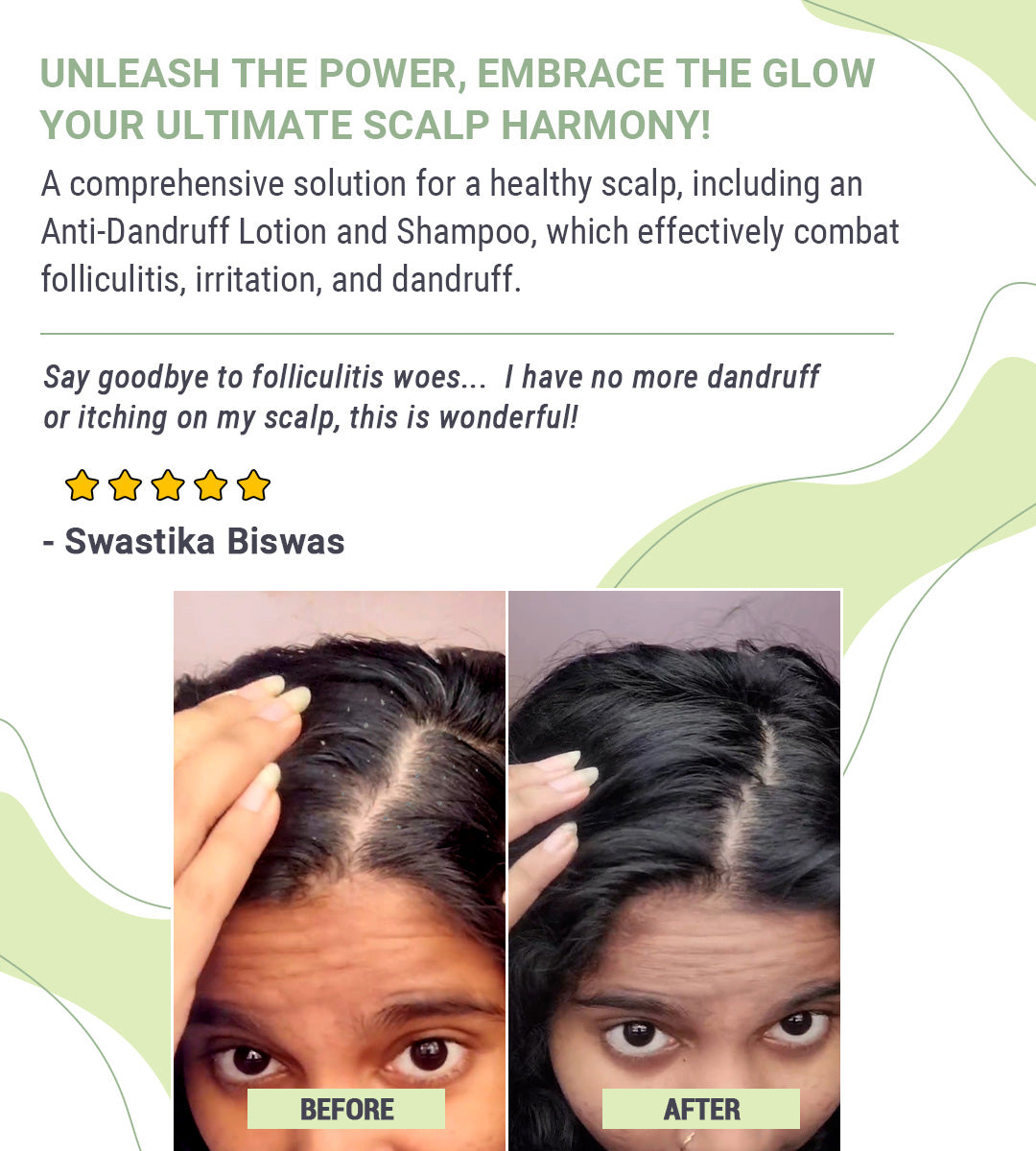 Teenilicious Anti Dandruff Scalp Lotion - How Is It Different - Mobile View