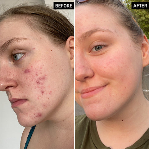 before and after using inkey list products