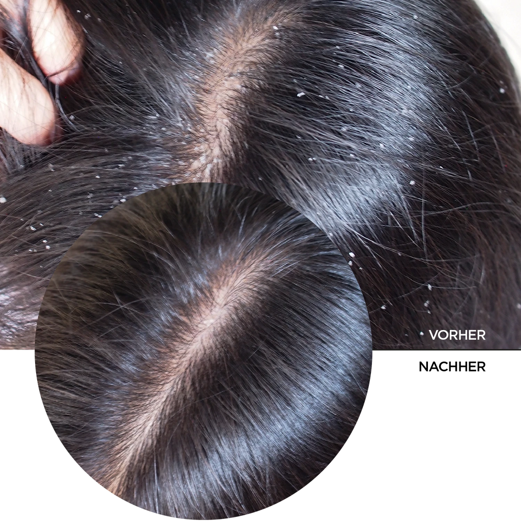 Hyaluronsäure 2% für das Haar