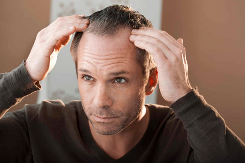 Man with hair loss