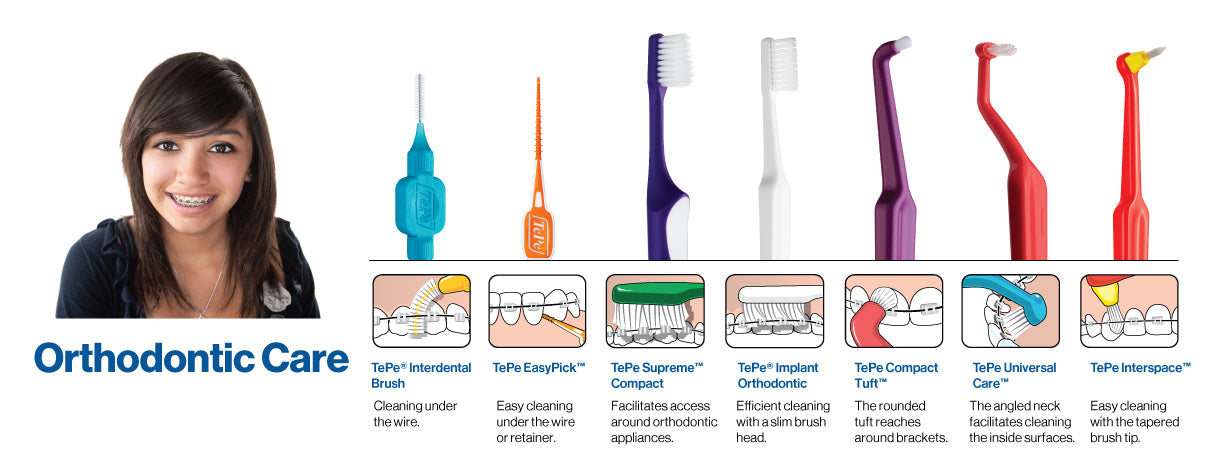 What Are Dental Tools?, Orthodontic Services