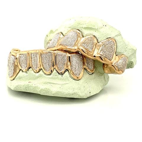 seattle gold grillz buy now