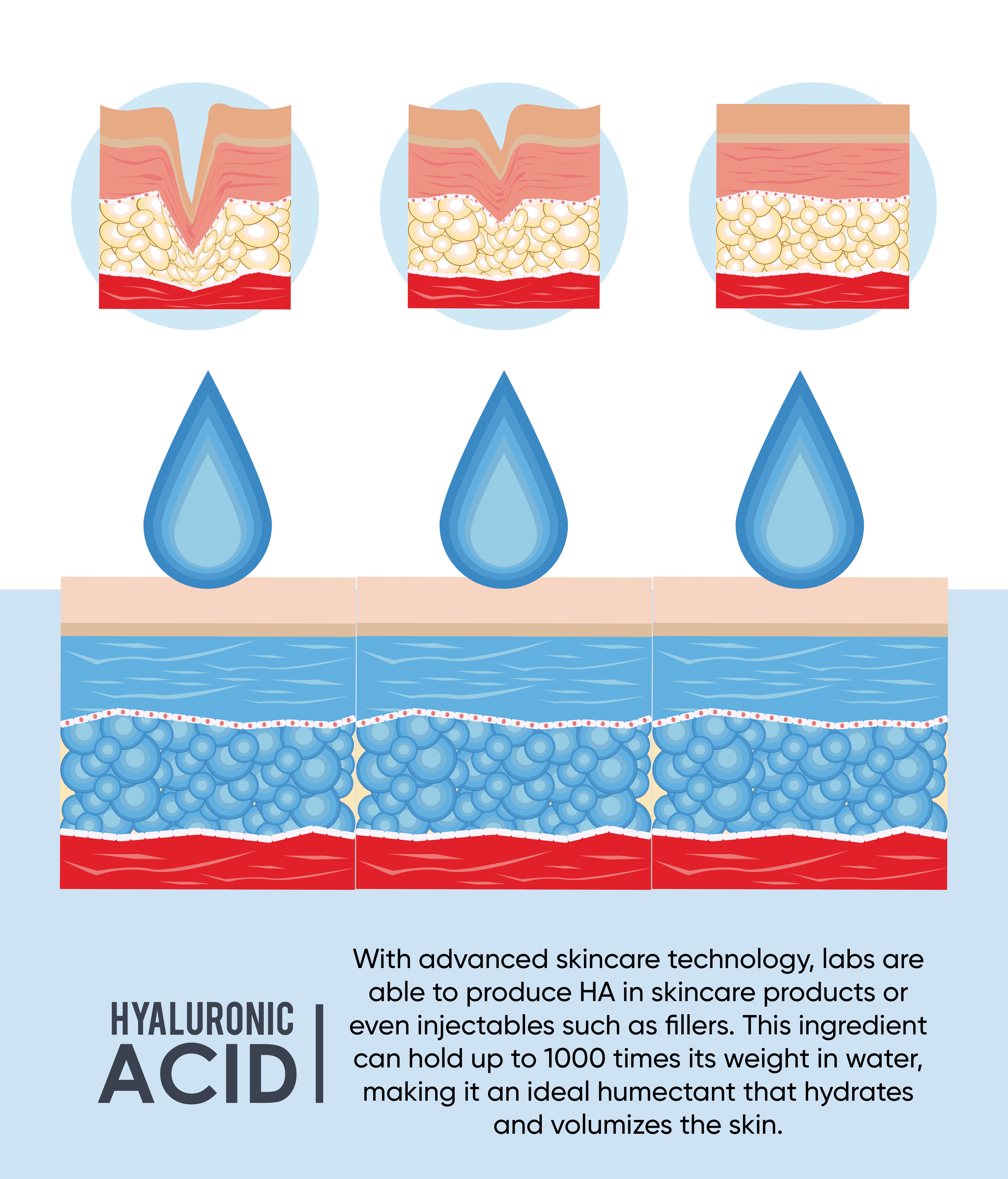 Hyaluronic Acid Spotlight diagram - M Tips 80