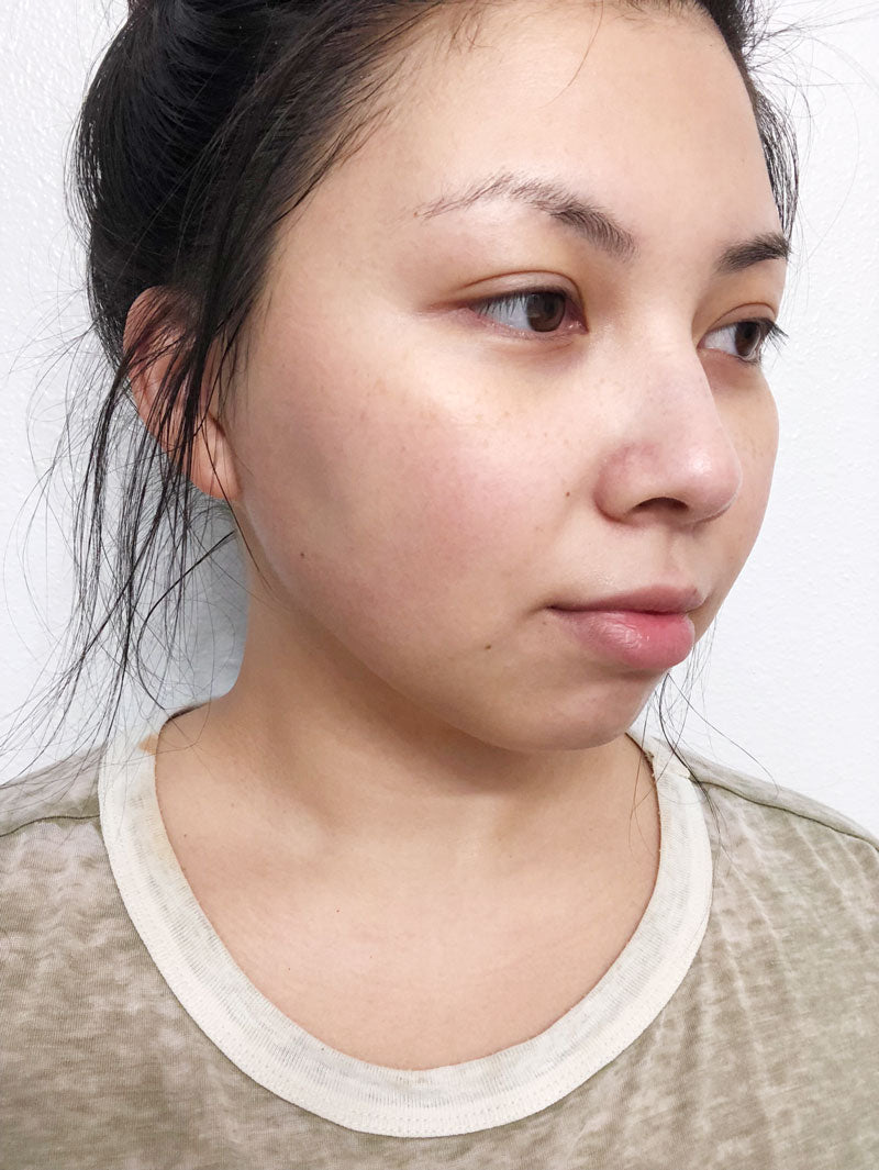 Dr Jart Clearing Mask before- M Review 66