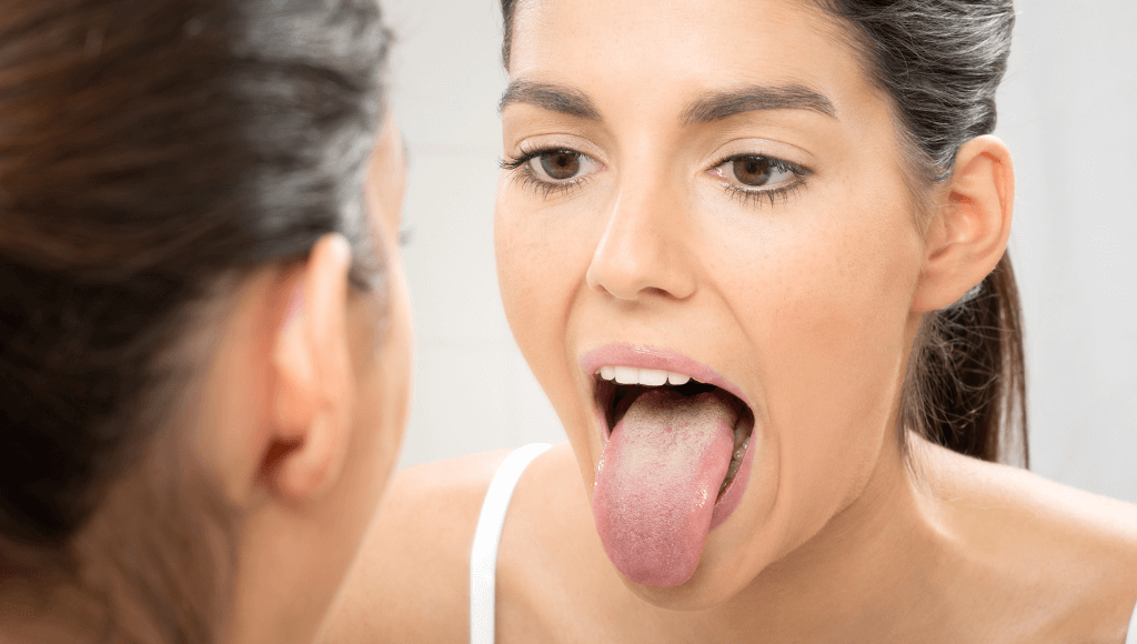 Langue blanche ou saburrale : causes et traitements – MyVariations