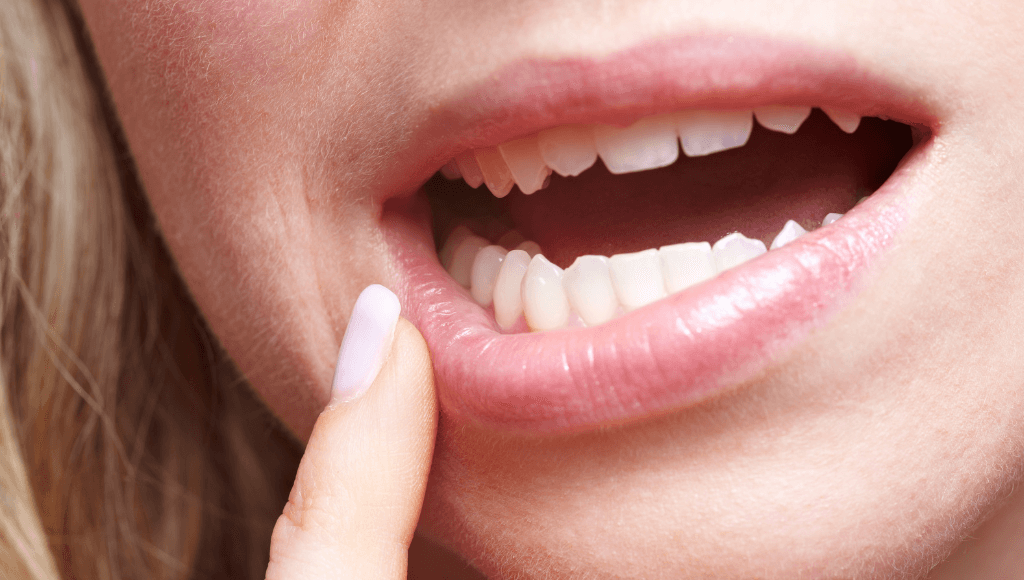 Peroxyde d'hydrogène pour les dents et gencives ? – MyVariations