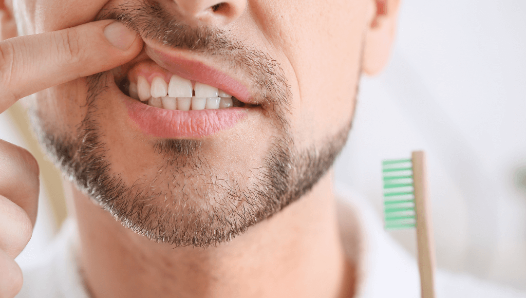 DIY : pansement dentaire maison - Sourire à pleines dents