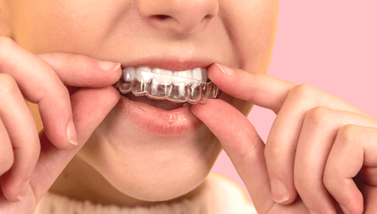 Woman putting plastic tray on her upper teeth against pink background