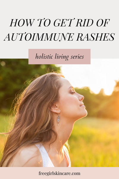 get rid of autoimmune rashes for beautiful skin
