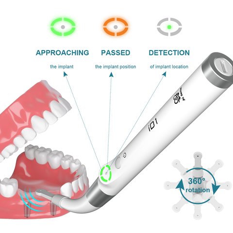 Dental implant locator