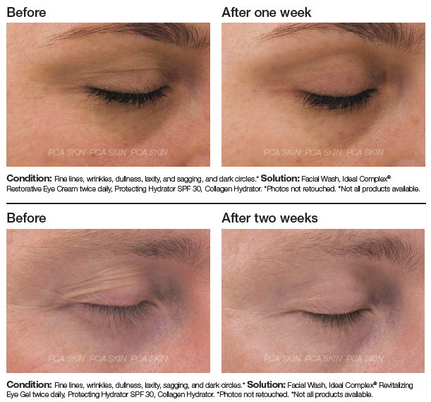 Ideal Complex Revitalizing Eye Gel & Restorative Eye Cream
