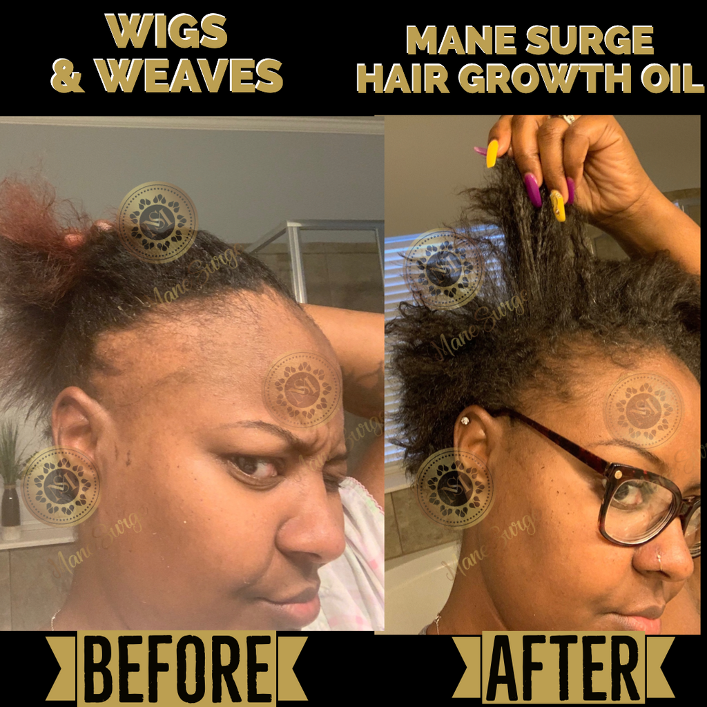 Mane Surge® Hair Care Growth Systems- Nothing But Beautiful Hair®