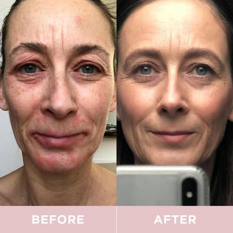 marine collagen drink before and after