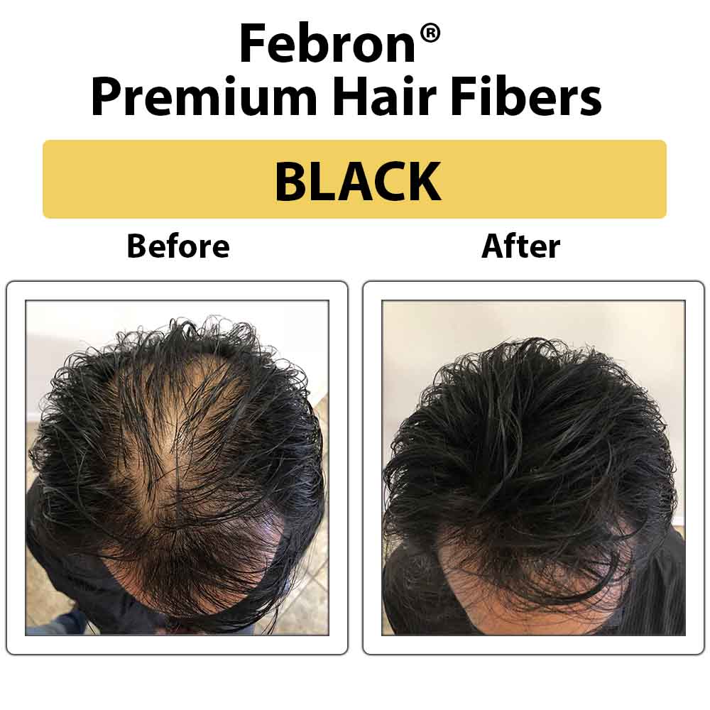 3 IN 1 Premium Febron Hair Building Fibers
