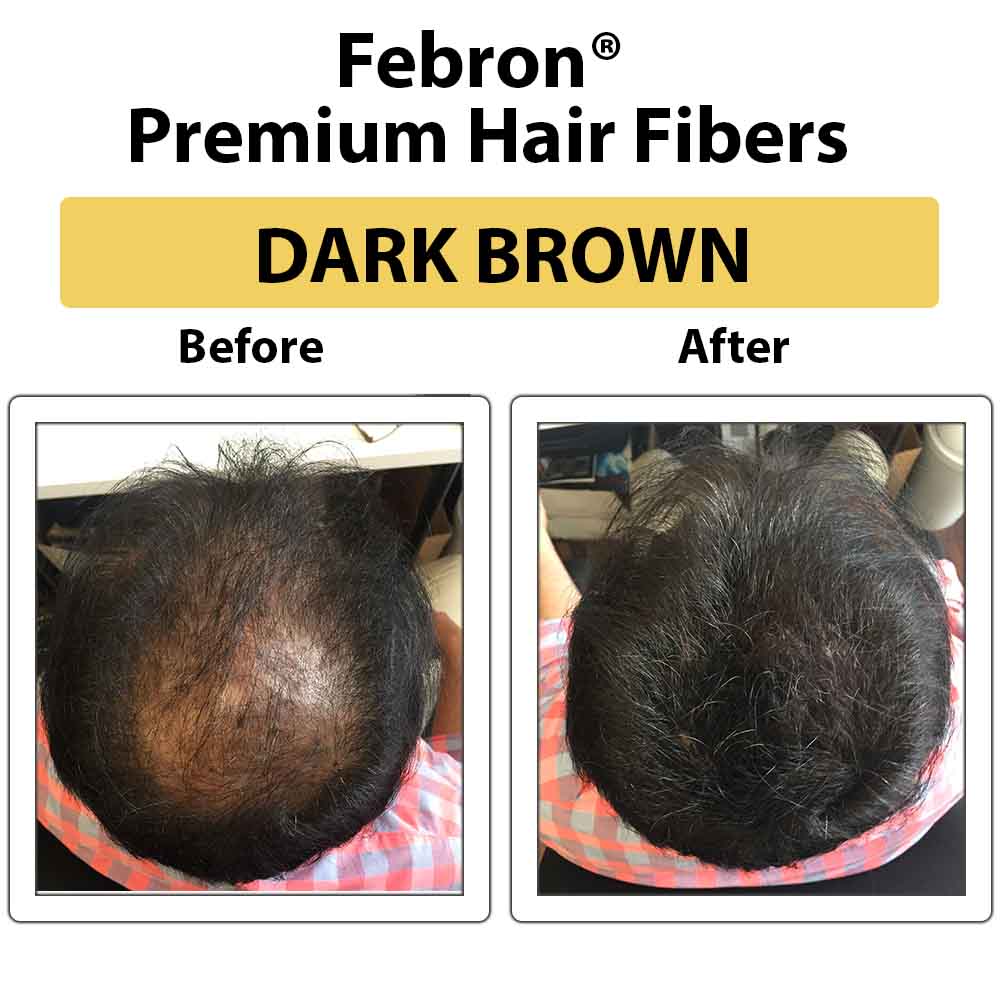 Are There Any Hair Fibre Side Effects  Nut Job Hair Building Fibres
