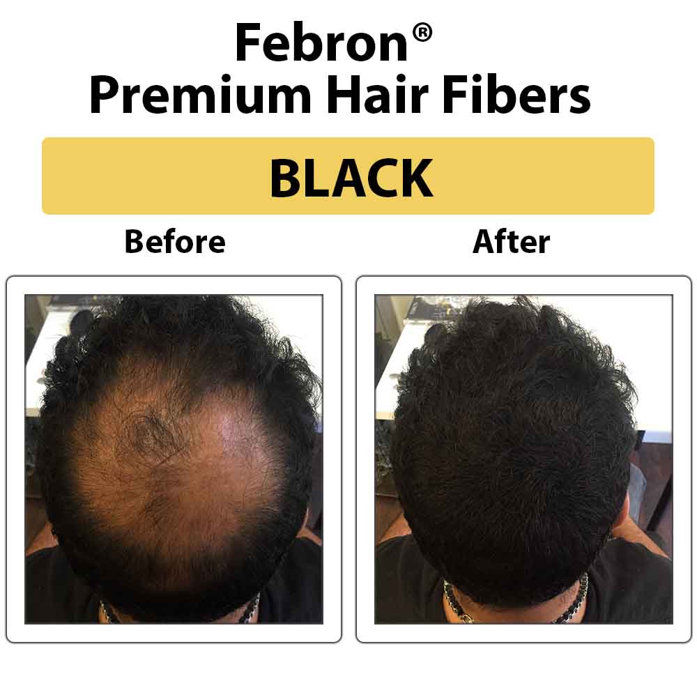 FEBRON Hair Fibers For Thinning Hair DARK BROWN For Women  Men Hair Loss  Concealer Hair Powder Volumizing Based 100 Undetectable  Natural  Bald  Spots Filler 30 Gram Dark Brown 106