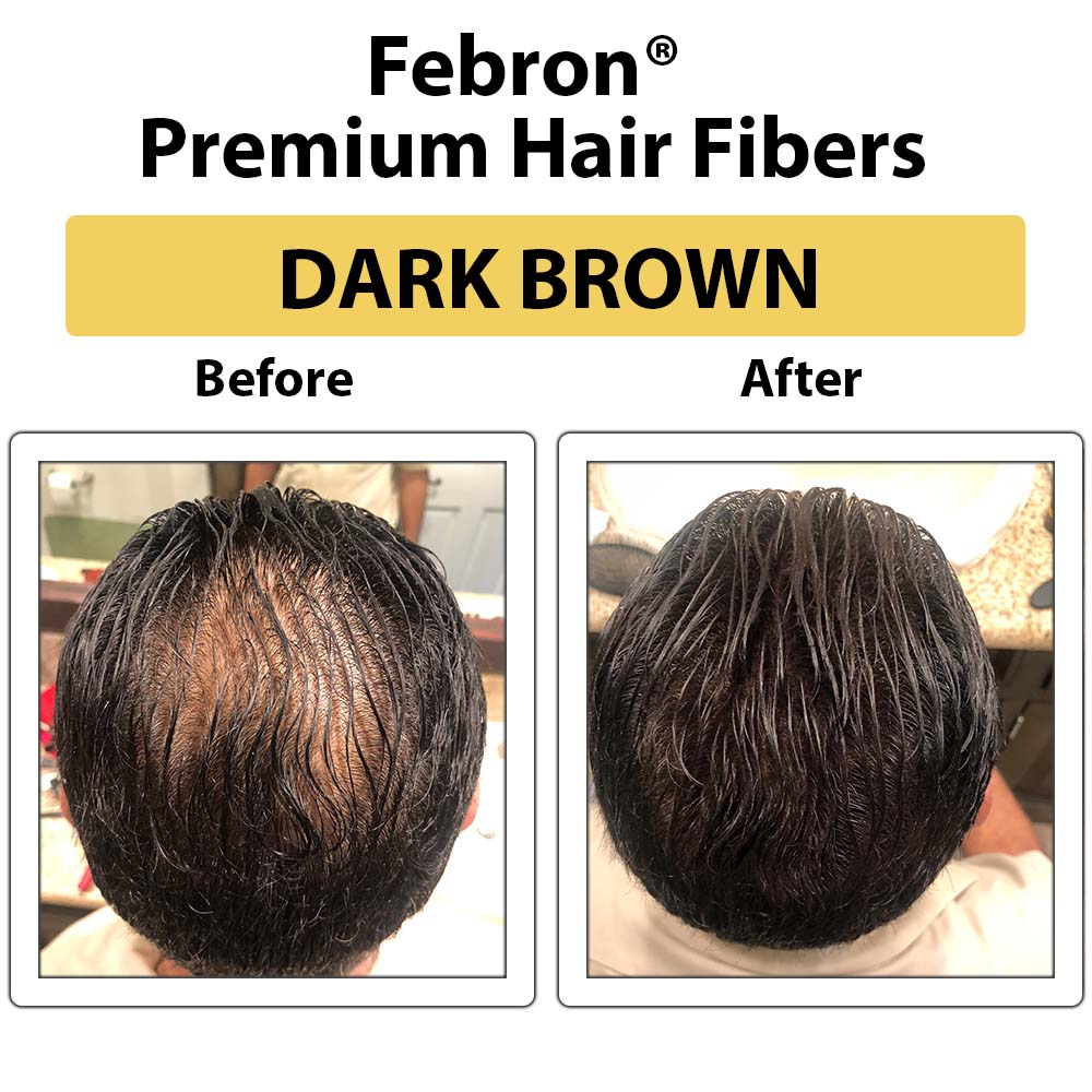 Toppik Hair Building Fibers Dark Brown Buy Toppik Hair Building Fibers  Dark Brown Online at Best Price in India  Nykaa