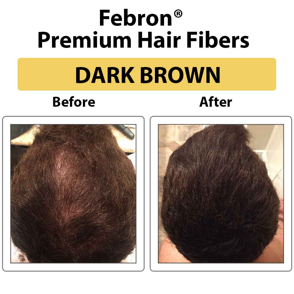 Hair Building Fibers Side Effects What You Need To Know  Bald Handsome  Man
