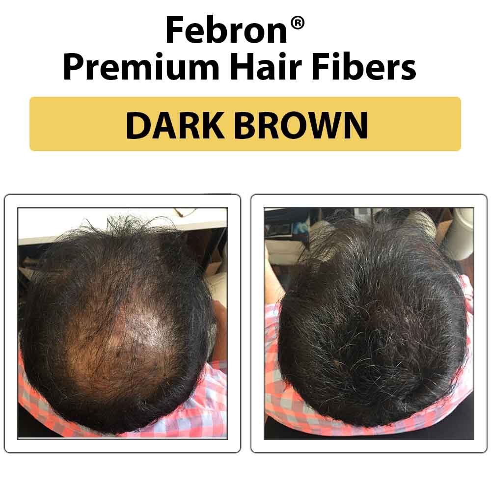 3 IN 1 Premium Febron Hair Building Fibers | Febron