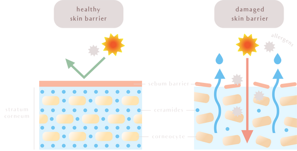 damaged disrupted skin barrier allergens sensitive skin