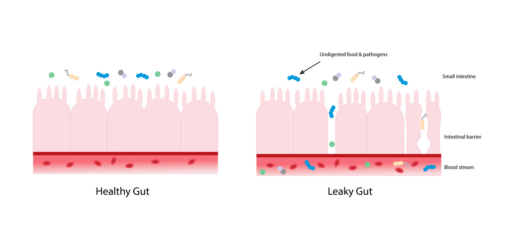 Leaky gut