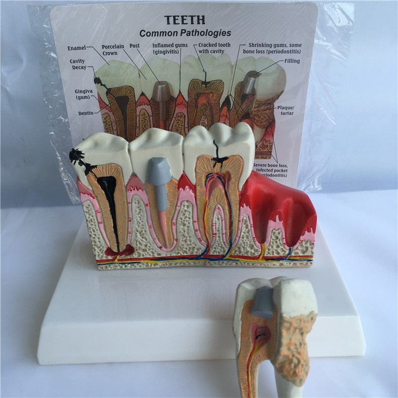 Introducir 108+ imagen modelo anatomico dental