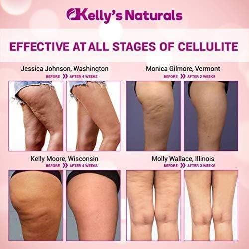 kelly's natural cellulite cream reviews