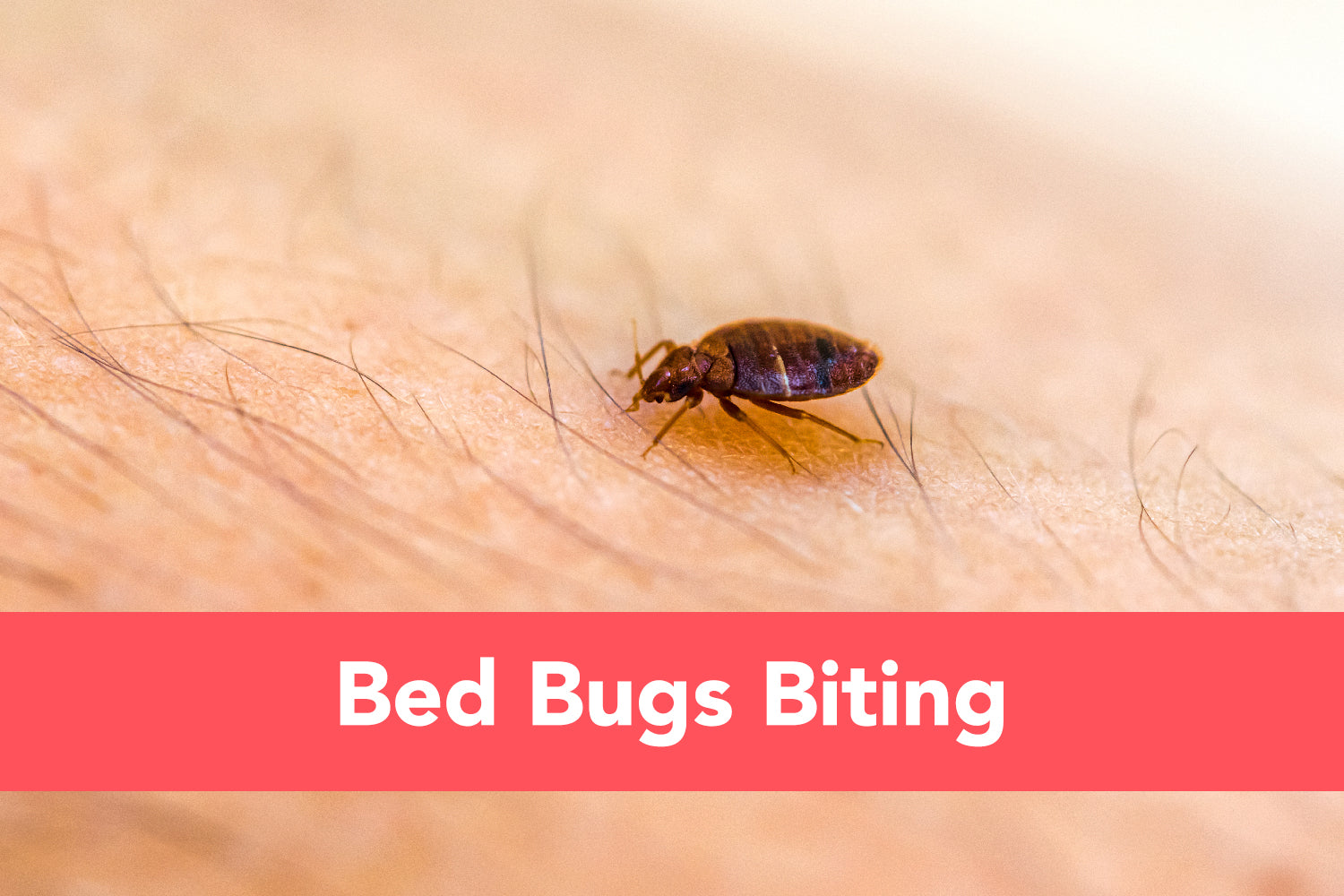 Bed Bugs Biting